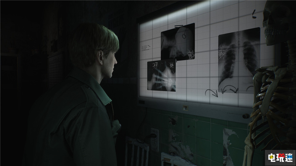 《寂靜嶺2重制版》開發(fā)商Bloober Team愿意繼續(xù)制作系列重制 恐怖游戲 Bloober Team 寂靜嶺2重制版 電玩迷資訊 第3張 《寂靜嶺2重制版》開發(fā)商Bloober Team愿意繼續(xù)制作系列重制 恐怖游戲 Bloober Team 寂靜嶺2重制版 電玩迷資訊 第3張